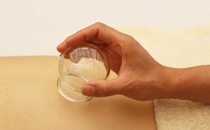 拔罐后為什么會出水泡 拔罐起水泡怎么處理