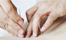 針灸可以調(diào)理月經(jīng)嗎 月經(jīng)不來針灸有效果嗎