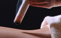 艾灸后皮膚癢怎么處理 艾灸后皮膚癢還能灸嗎