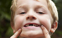 兒童齲齒掛什么科 兒童齲齒充填怎么進(jìn)行