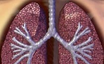 陽虛的癥狀有哪些 陽虛體質(zhì)如何調(diào)理