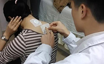 三伏貼一次貼幾貼 三伏貼醫(yī)保報(bào)銷嗎