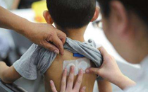 三伏貼可以一次最多貼多少貼 貼三伏貼一次貼多久最好