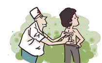 三伏貼燙傷后怎么處理 三伏貼燙傷不能吃什么