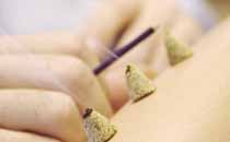 針灸多久做一次 針灸一次多長時(shí)間最好