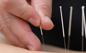 三伏貼每個小孩能貼嗎 兒童貼三伏貼要注意些什么