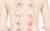 腰疼可以拔火罐嗎 腰疼拔火罐的位置及方式