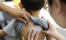 三伏貼為什么要貼三年 三伏貼貼完后癢怎么辦