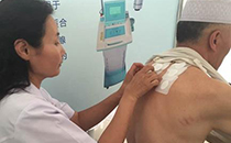 三伏貼什么牌子好 三伏貼費(fèi)用怎么算