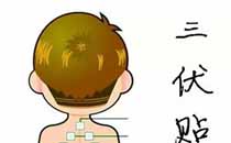 貼三伏貼可以吃水果嗎 貼三伏貼不能吃什么水果