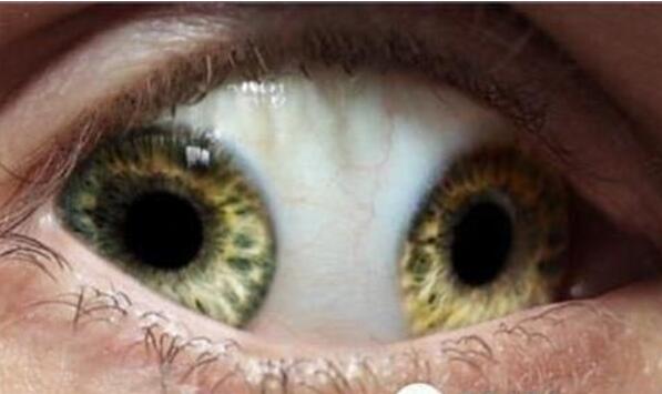 雙瞳孔眼乃絕世罕見，世界十大恐怖眼球大盤點(diǎn)(膽小慎入)