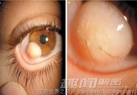 雙瞳孔眼乃絕世罕見，世界十大恐怖眼球大盤點(diǎn)(膽小慎入)