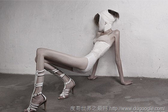 clip_image003 世界最瘦的人,只有22公斤的女孩Ariel