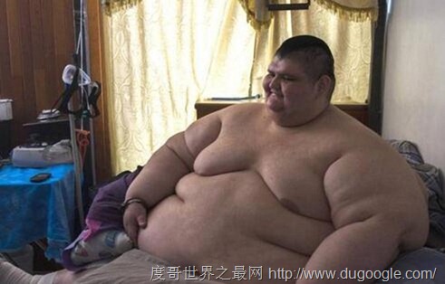 墨西哥男子體重曾達(dá)半噸, Juan Pedro Franco減肥170公斤