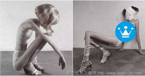 世界最瘦的人,只有22公斤的女孩Ariel 世界最瘦的人,只有22公斤的女孩Ariel