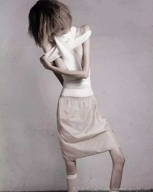 clip_image006 世界最瘦的人,只有22公斤的女孩Ariel